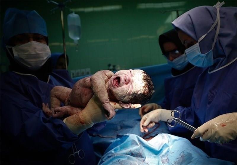 ترفندهایی برای کاستن از ریسک سزارین