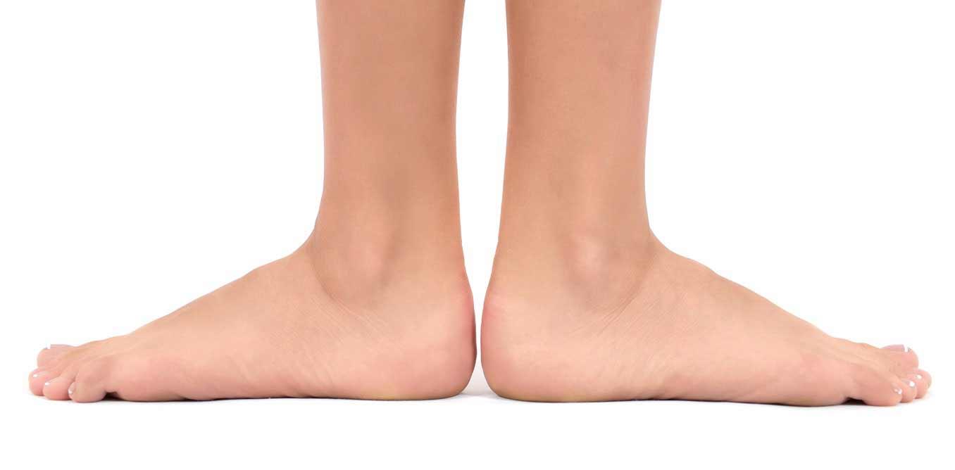 راهکار‌های تشخیص کف پای صاف/ چاقی نقشی در صافی کف پا ندارد