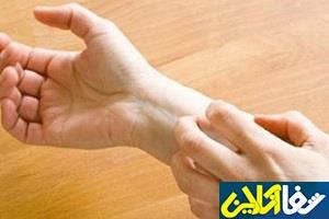 بخور و نخورهای غذایی اگزمای پوستی