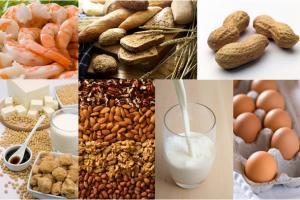 علائم آلرژی غذایی را بیشتر بشناسیم