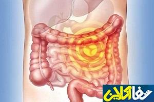 کاهش ابتلا به سرطان روده با مصرف حبوبات