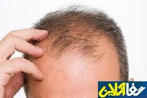 ارتباط ریزش مو با صرف صبحانه!